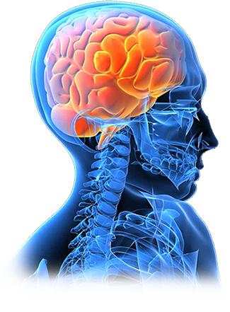 image of body silhouette from the shoulders up with the bones and brain detailed cerebral aneurysms and ependymoma
