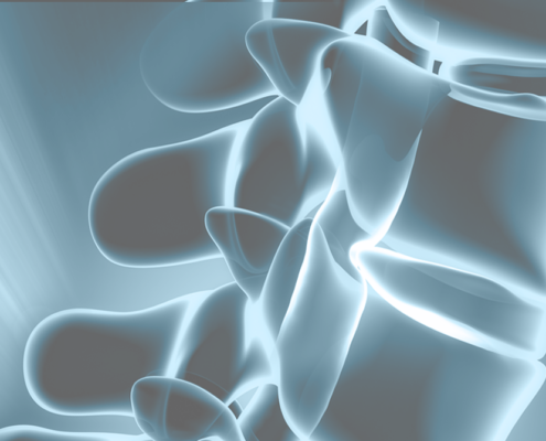 Minimally Invasive Spinal Surgery